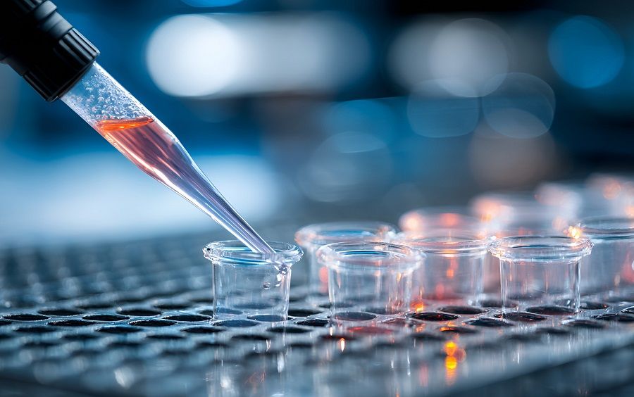 自动化分血工作站：样本前处理的高效 “领航者”